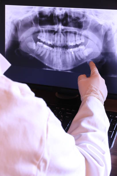 Best Broken or Chipped Tooth Repair in La Porte, IN